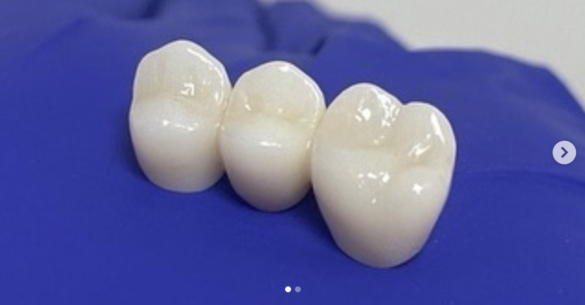 Cirkonijumski most — Pro Dental Solutions